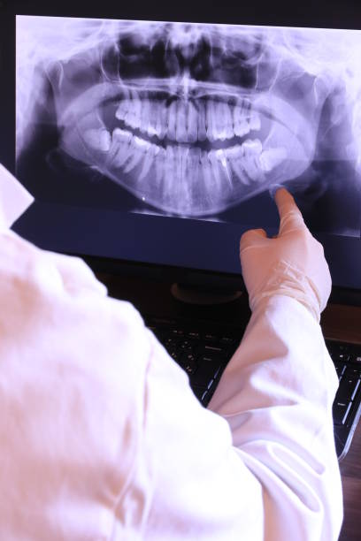 Best Emergency Root Canal Treatment in Jacksonville, AR