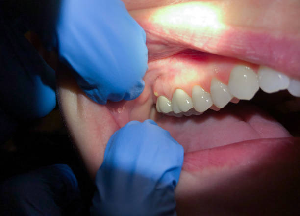 Best Emergency Dental Care for Trauma or Injury in Jacksonville, AR